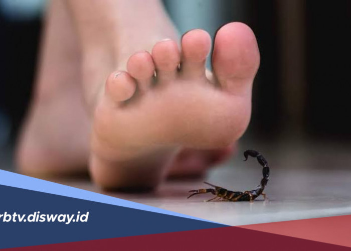 5 Langkah Pertolongan Pertama Saat Disengat Kalajengking