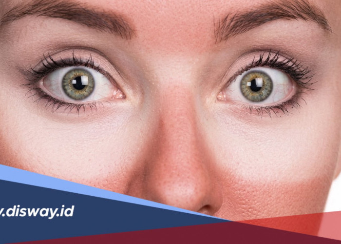 Pakai Sunscreen tapi Wajah Tetap Belang, Kesalahan Sepele Ini Bisa Jadi Penyebabnya