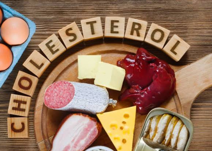 Perhatian, Ini Kebiasaan Buruk Pemicu Kolesterol, Nomor 1 Sangat Sering Dilakukan