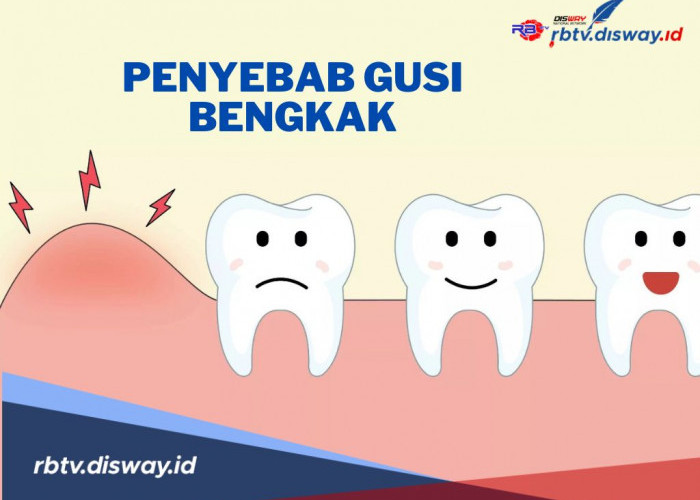 Apa Penyebab Gusi Bengkak? Menurut Ustadz Dhanu, Coba Perhatikan Hal Ini