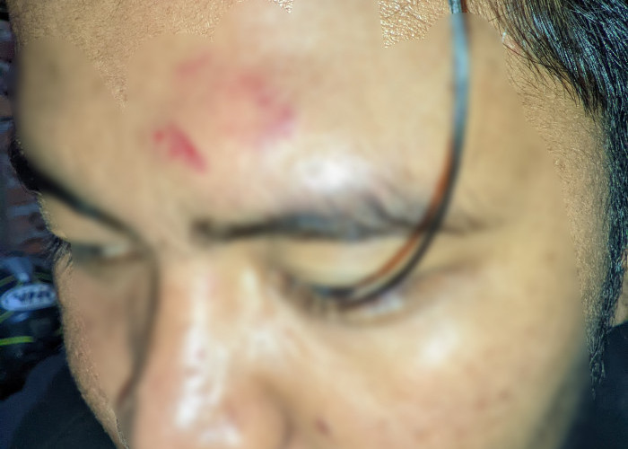 Waspada Aksi Berandalan Meneror, Pengunjung Wisata Danau Dendam Bengkulu Jadi Korban