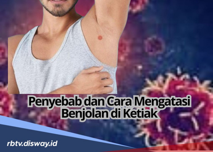 Punya Benjolan di Ketiak yang Bikin Khawatir, Ini 6 Penyebab dan Cara Mengatasinya