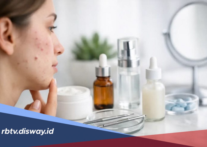 Jerawat Muncul Setelah Ganti Skincare, Kenali Tandanya