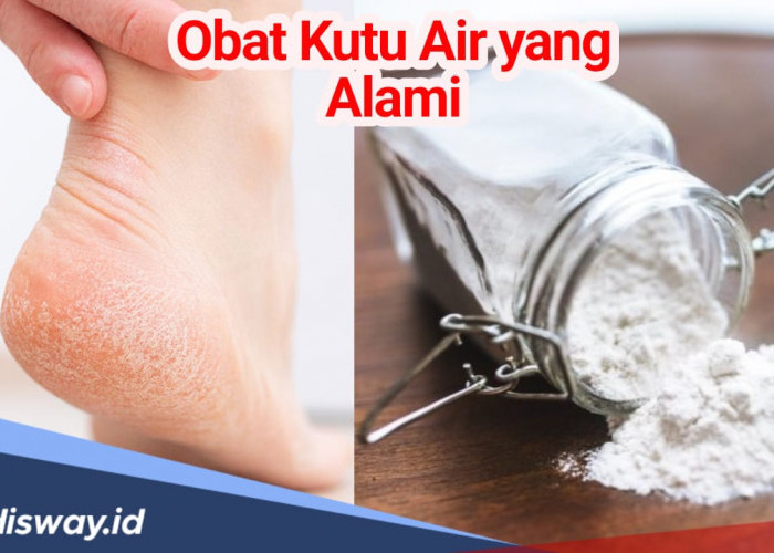 7 Obat Alami untuk Basmi Kutu Air, Bisa Ditemukan di Rumah