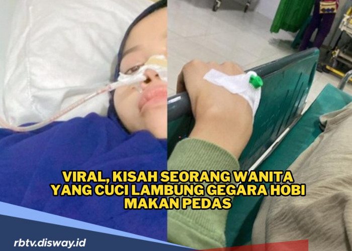 Viral, Kisah Seorang Wanita yang Cuci Lambung Gegara Hobi Makan Pedas, Ini Dampaknya! 