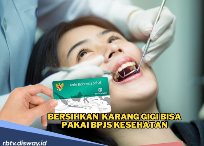 Banyak yang Belum Tahu, Ternyata Bersihkan Karang Gigi Bisa Pakai BPJS Kesehatan, Ini Syarat dan Prosedurnya