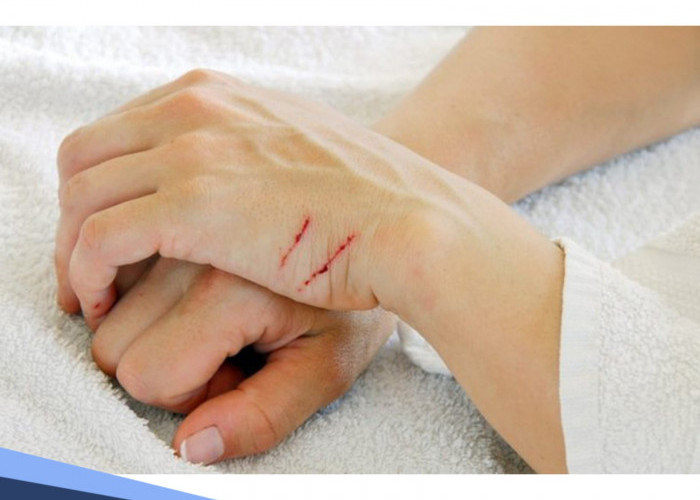 Jurus Jitu Menghilangkan Bekas Luka Membandel, Cukup Pakai 3 Bahan Alami Ini