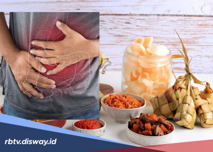 Waspada! Jangan Lupa Diri, Ini Penyakit yang Sering Muncul Setelah Lebaran