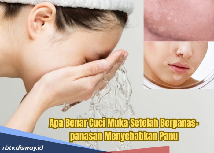 Cuci Muka Habis Berpanas-panasan Bisa Sebabkan Panu, Ini Kata Dokter Tirta