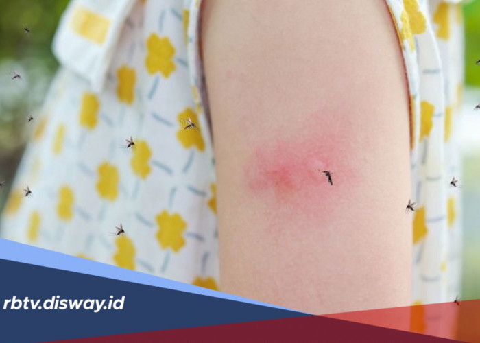 Apakah Demam Berdarah Menular? Simak Penjelasan Berikut