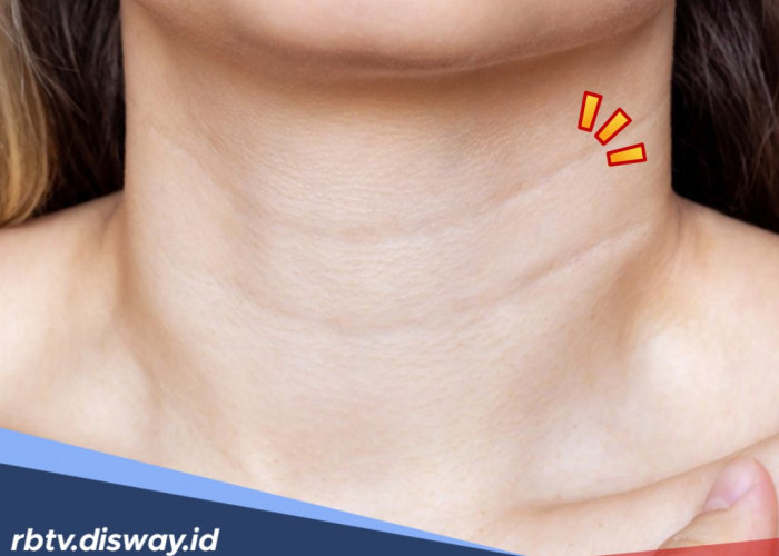 Jangan Nikahi Wanita dengan Leher Tali Kapal, jika Tidak Mau Seperti Ini 