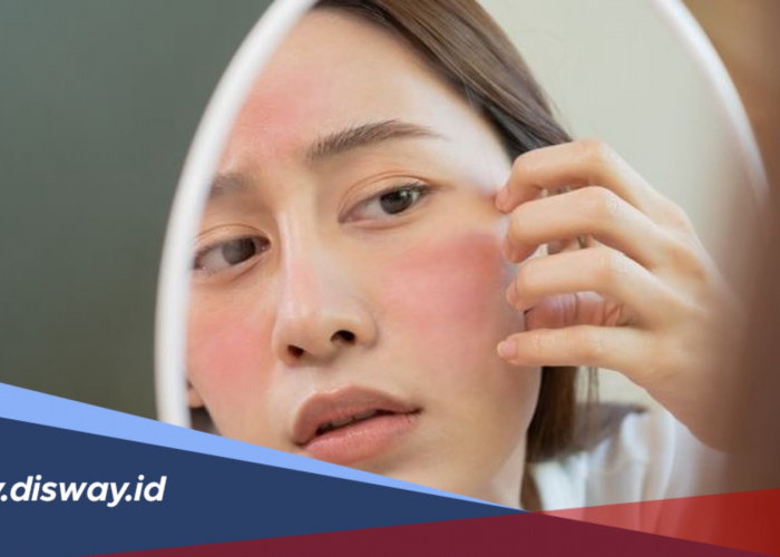 Berapa Lama Skin Barrier Rusak Bisa Pulih? Kenali Tanda dan Cara Merawatnya
