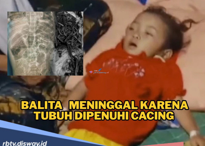 Kisah Pilu Raya, Balita yang Meninggal dengan Tubuh Dipenuhi Cacing, Ini Penyebabnya
