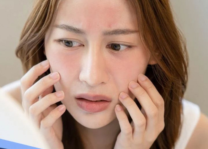 Rekomendasi Skincare dan Perawatan Kulit Sensitive, Jaga Penampilan dengan Perawatan yang Tepat