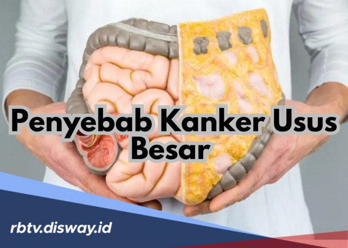 12 Penyebab Kanker Usus Besar, Penyakit Berbahaya yang Sering Diabaikan