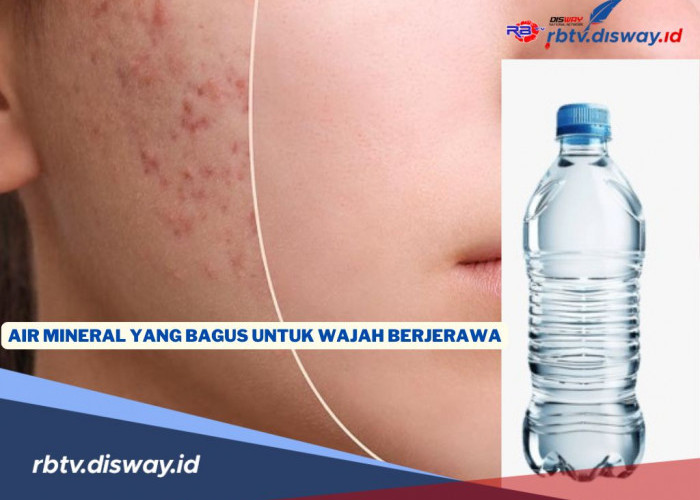  Air Mineral yang Bagus Bisa Bantu Atasi Jerawat, Rahasia Kulit Lebih Bersih