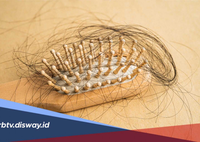 Jarang Disadari, Ini 4 Kebiasaan Buruk Bikin Rambut Rontok