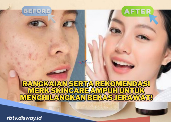 Ini Rekomendasi Merek Skincare Ampuh untuk Menghilangkan Bekas Jerawat, Harga Ramah Dikantong