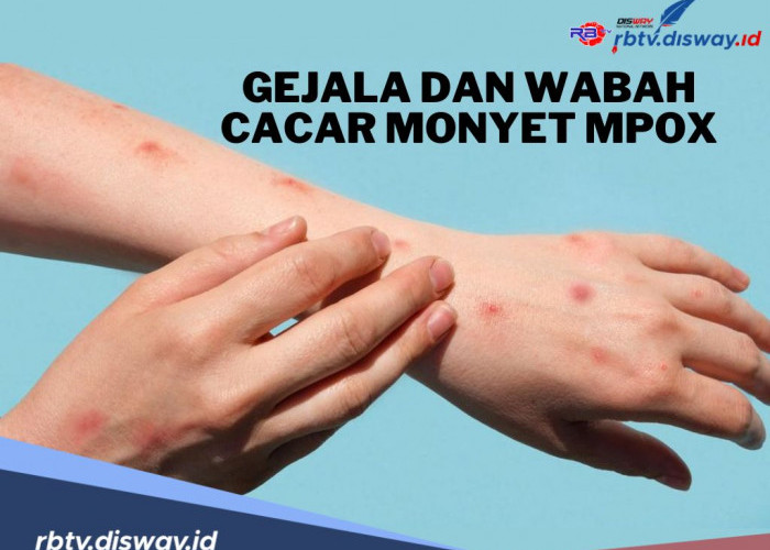 Waspada Wabah Cacar Monyet Mpox, Kenali Gejala Awal dan Risiko Penularannya