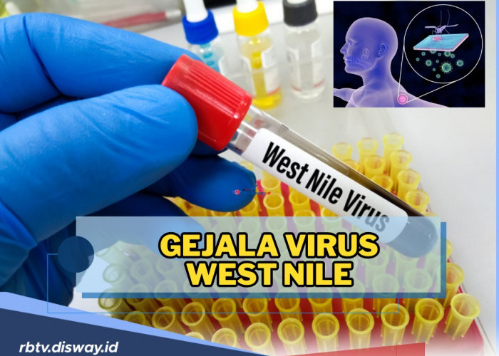 Virus West Nile Mewabah di Israel, Ini Gejala yang Harus Diwaspadai