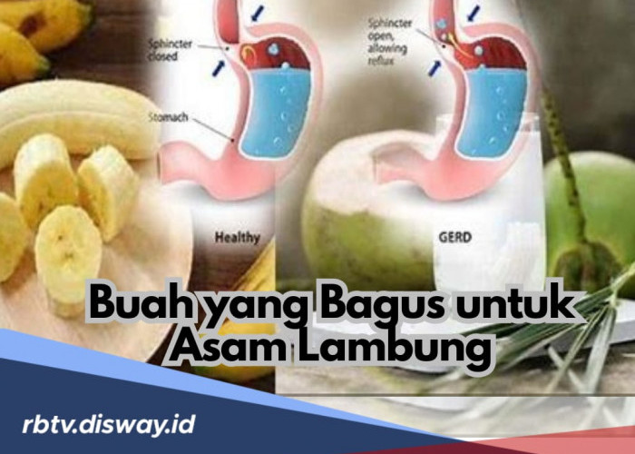 Ini 9 Buah yang Baik untuk Penderita Asam Lambung, Makan Tak Perlu Was-was