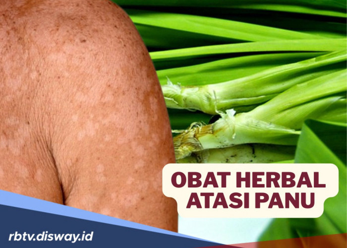 Tak Perlu Salap, Coba Gunakan Obat Herbal Alami Ini untuk Atasi Panu, Paling Ampuh dan Hemat
