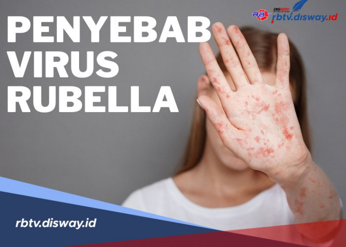 Ini Penyebab Virus Rubella, Waspada Karena Cepat Menular Ke Ibu Hamil dan Anak-anak