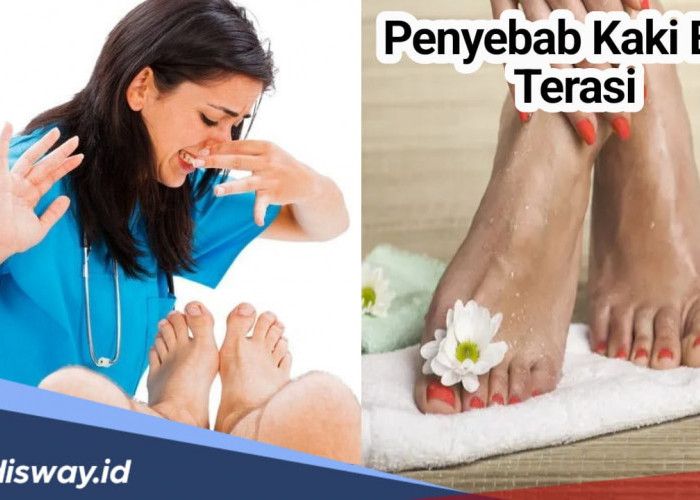 Kaki Bau Terasi Bikin Minder, Ini 6 Penyebab dan 8 Cara Mengatasinya