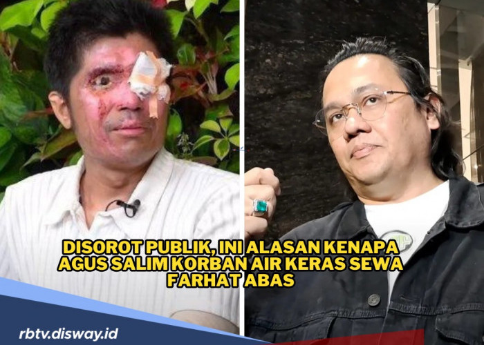 Jadi Sorotan Publik, Ini Alasan Kenapa Agus Salim Korban Air Keras Sewa Farhat Abbas