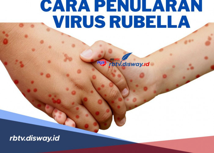 Begini Cara Penularan Virus Rubella, Harus Diwaspadai Terutama Ibu Hamil