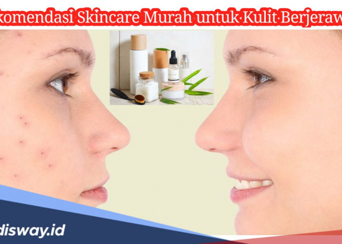 Ini 8 Rekomendasi Skincare Murah Cocok untuk Wajah Berjerawat, Harganya Cuma Segini