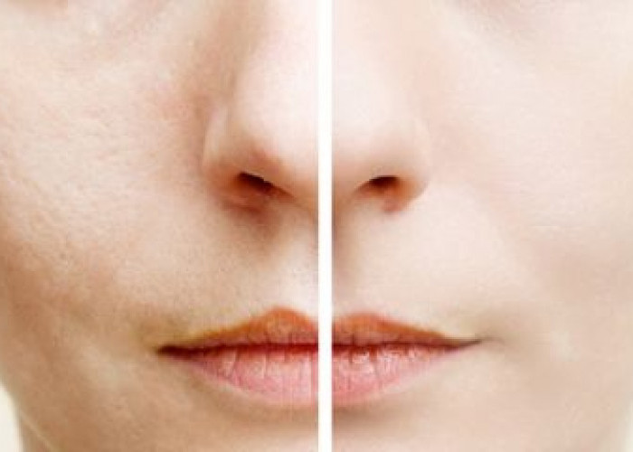 7 Rekomendasi Skincare untuk Mengecilkan Pori-Pori Wajah Agar Kulit Terlihat Lebih Mulus