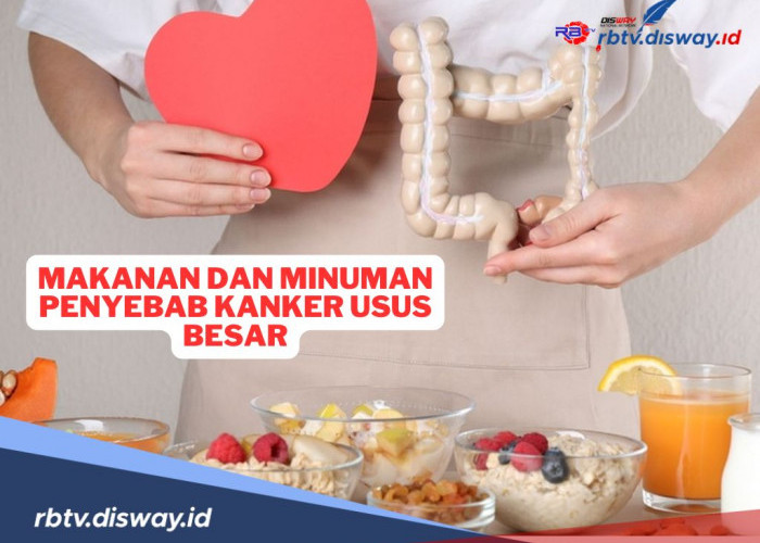 Ini Makanan dan Minuman Penyebab Kanker Usus Besar yang Perlu Diwaspadai