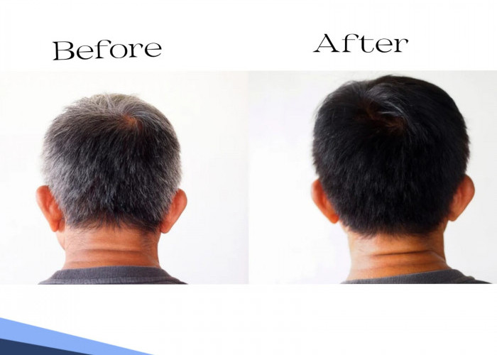 Bukan Dicat Apalagi Disemir, Ini Cara Menghilangkan Uban dengan Bahan Alami