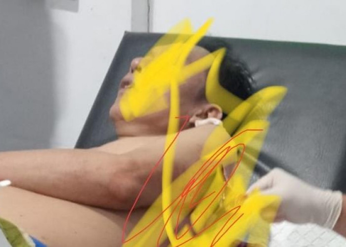 Kades Padang Genteng Kaur Kena Bacok, Lengan dan Punggung Terluka