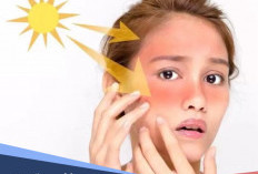 Manfaat Sunscreen untuk Kulit Wajah Sangat Penting! Jangan Sampai Terlewat