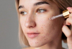 5 Skincare Korea untuk Kulit Berjerawat, Wajah Mulus Bebas Breakout