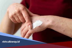 4 Rekomendasi Salep yang Ampuh Hilangkan Gatal di Kulit, Tersedia di Apotek