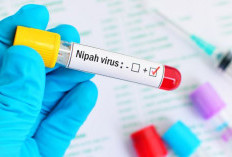 Virus Nipah Sedang Merebak di India, Sudah Terdeteksi di Indonesia?