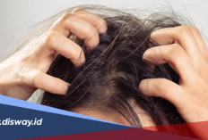 Jangan Digaruk, Coba 5 Bahan Alami Ini untuk Mengatasi Kulit Kepala Gatal