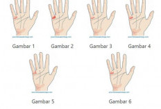 Ramalan Garis Tangan, Jika Punya Tanda Seperti Ini Bakal Jadi Orang Kaya di 2026
