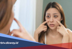 Kantong Mata dan Mata Panda Bikin Wajah Kusam! Coba Cara Ini