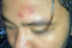 Waspada Aksi Berandalan Jalanan di Kota Bengkulu Meneror, 2 Pemuda Jadi Korban 