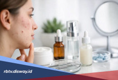 Jerawat Muncul Setelah Ganti Skincare, Kenali Tandanya