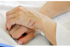 Jurus Jitu Menghilangkan Bekas Luka Membandel, Cukup Pakai 3 Bahan Alami Ini