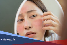Berapa Lama Skin Barrier Rusak Bisa Pulih? Kenali Tanda dan Cara Merawatnya