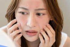 Rekomendasi Skincare dan Perawatan Kulit Sensitive, Jaga Penampilan dengan Perawatan yang Tepat