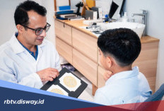 Apakah Buta Warna Bisa Disembuhkan? Simak Penjelasan Berikut