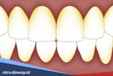 Tak Perlu ke Dokter? Begini 10 Cara Alami Bersihkan Plak Gigi
