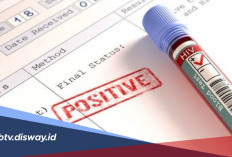 HIV dan AIDS: Kenali Perbedaan, Gejala serta Cara Penularannya